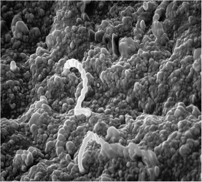 Investigating the Immunological and Biological Equilibrium of Reservoir Hosts and Pathogenic Leptospira: Balancing the Solution to an Acute Problem?